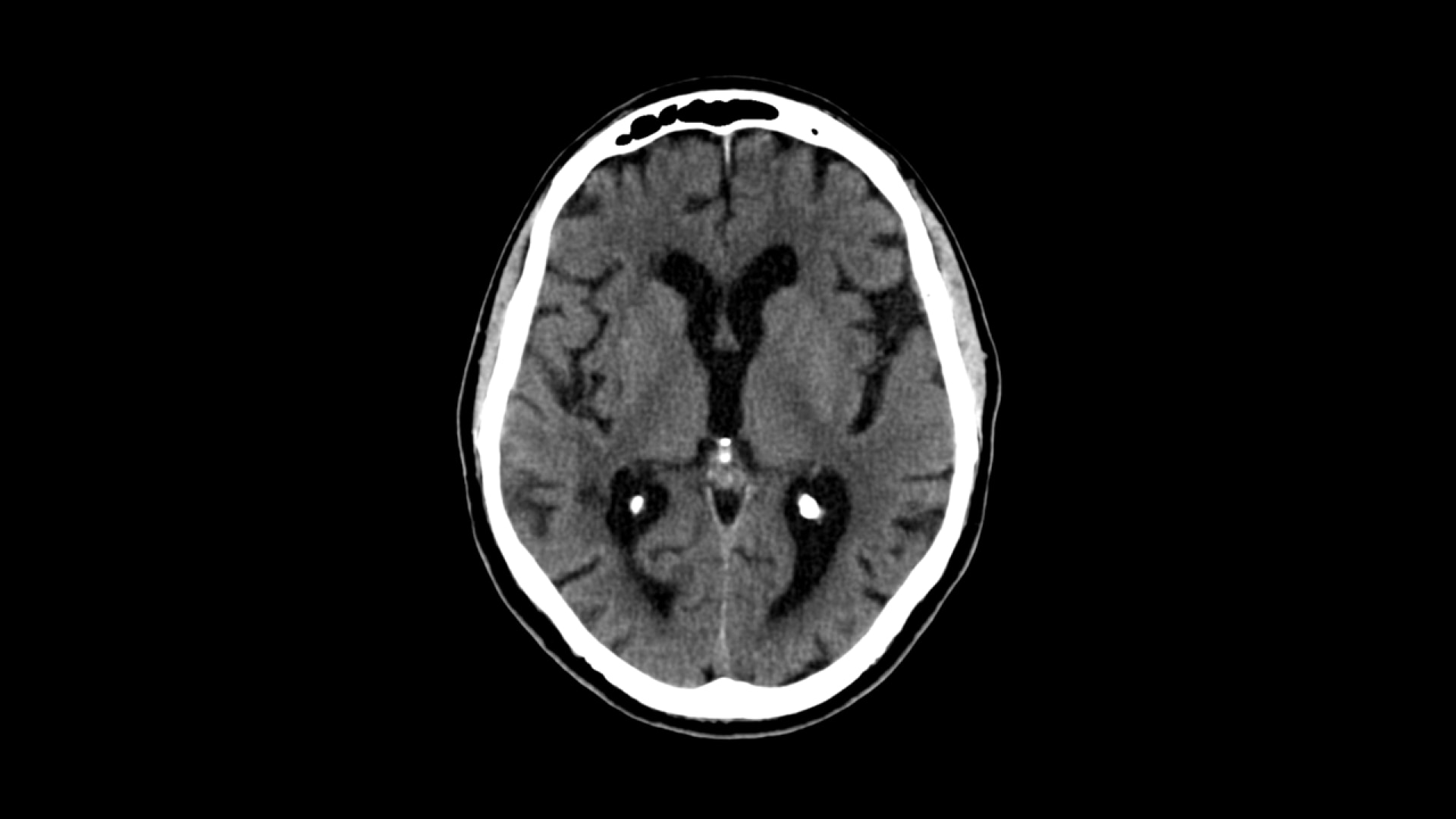 Product Media Carousel Image