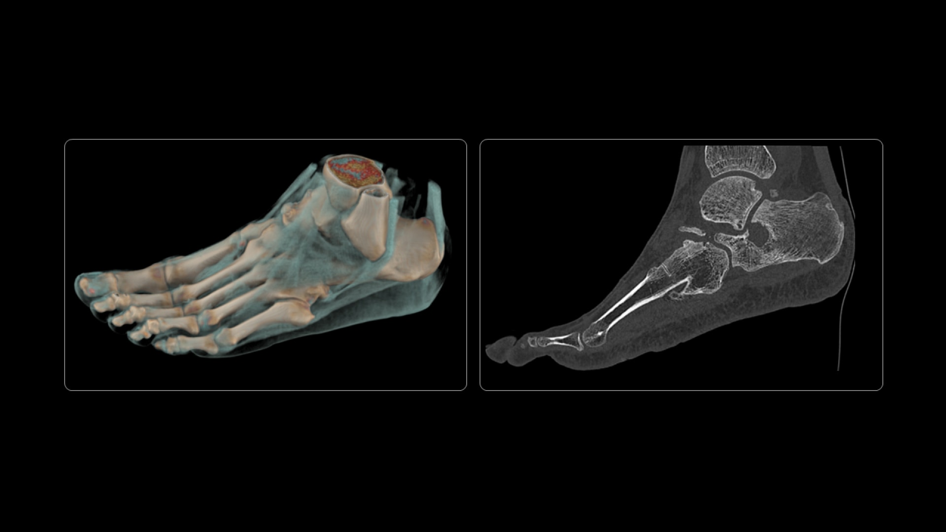 Product Media Carousel Image