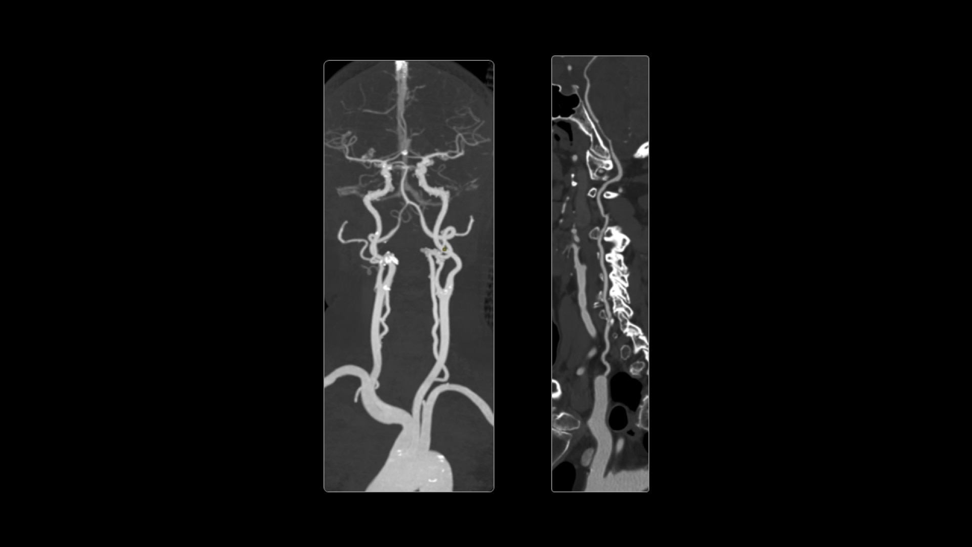 Product Media Carousel Image