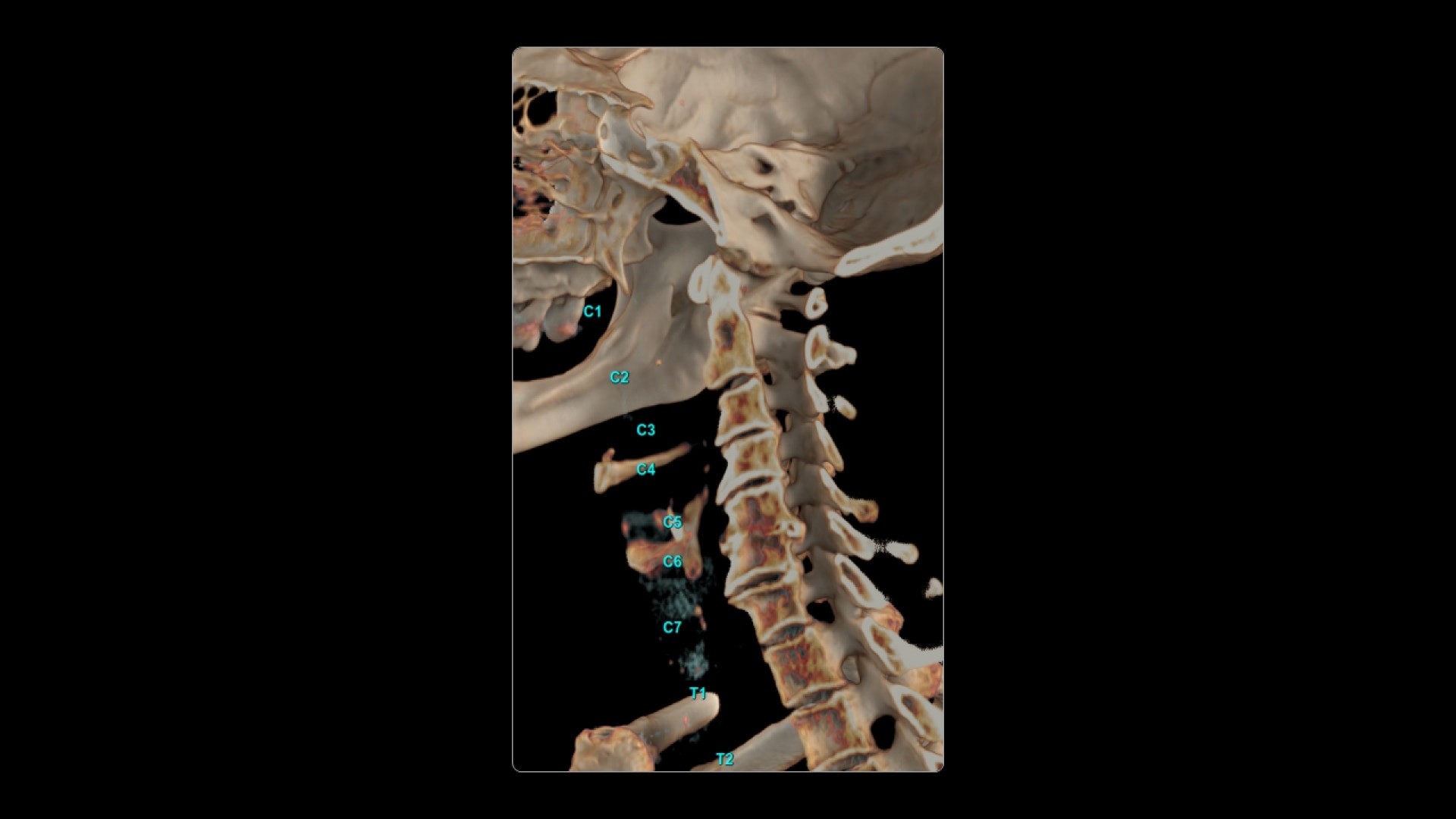 Product Media Carousel Image