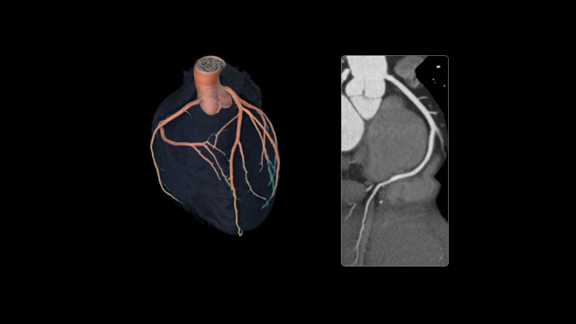 Product Media Carousel Image