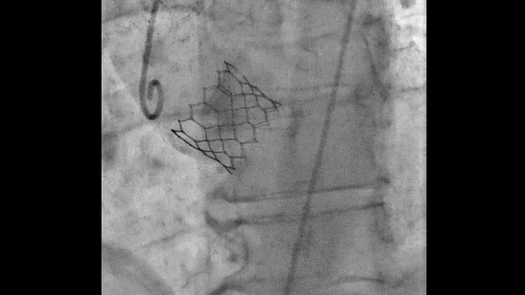 Product Media Carousel Image