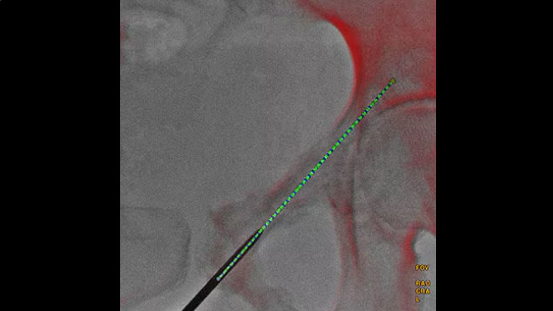 Product Media Carousel Image