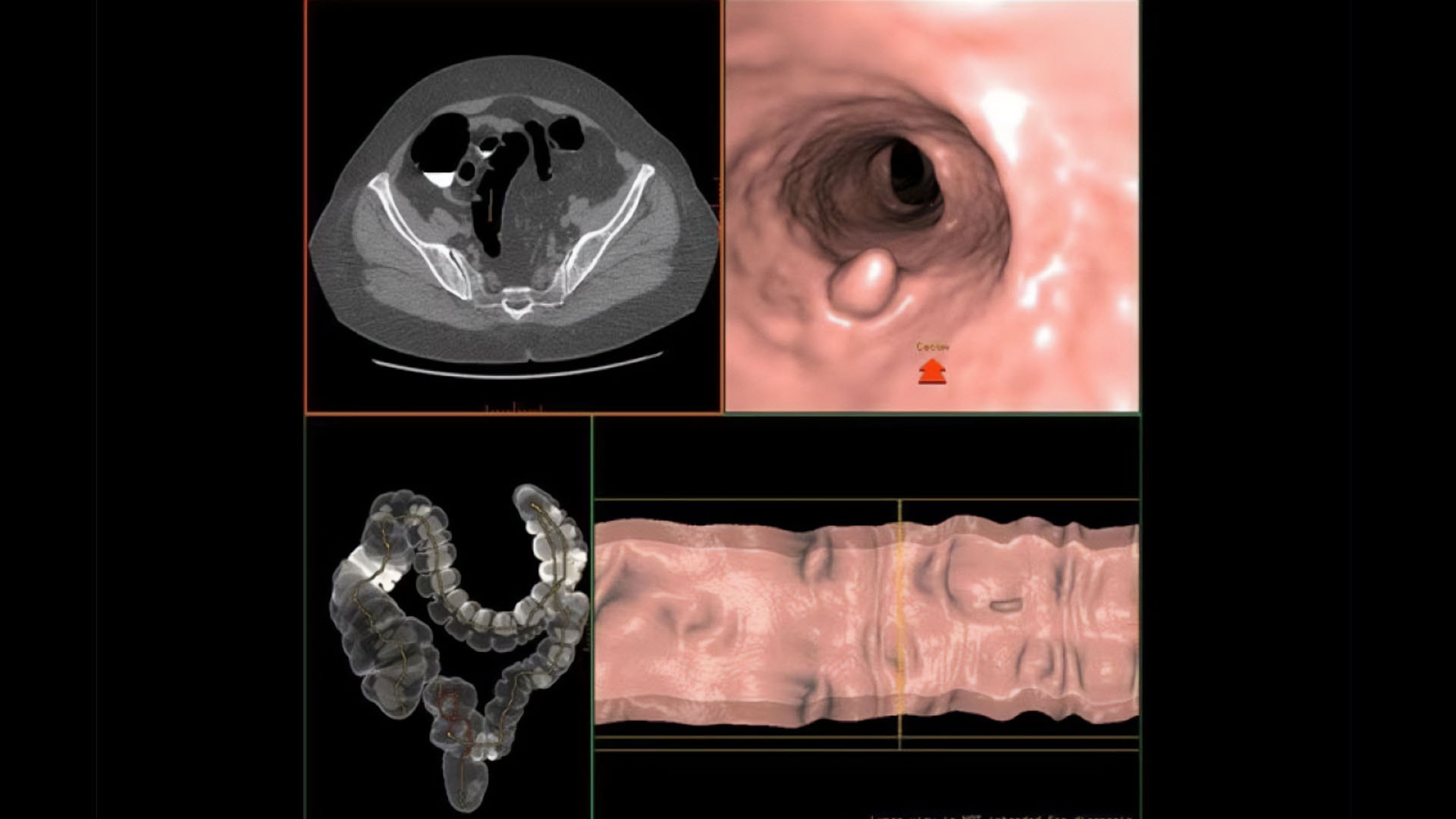 Product Media Carousel Image