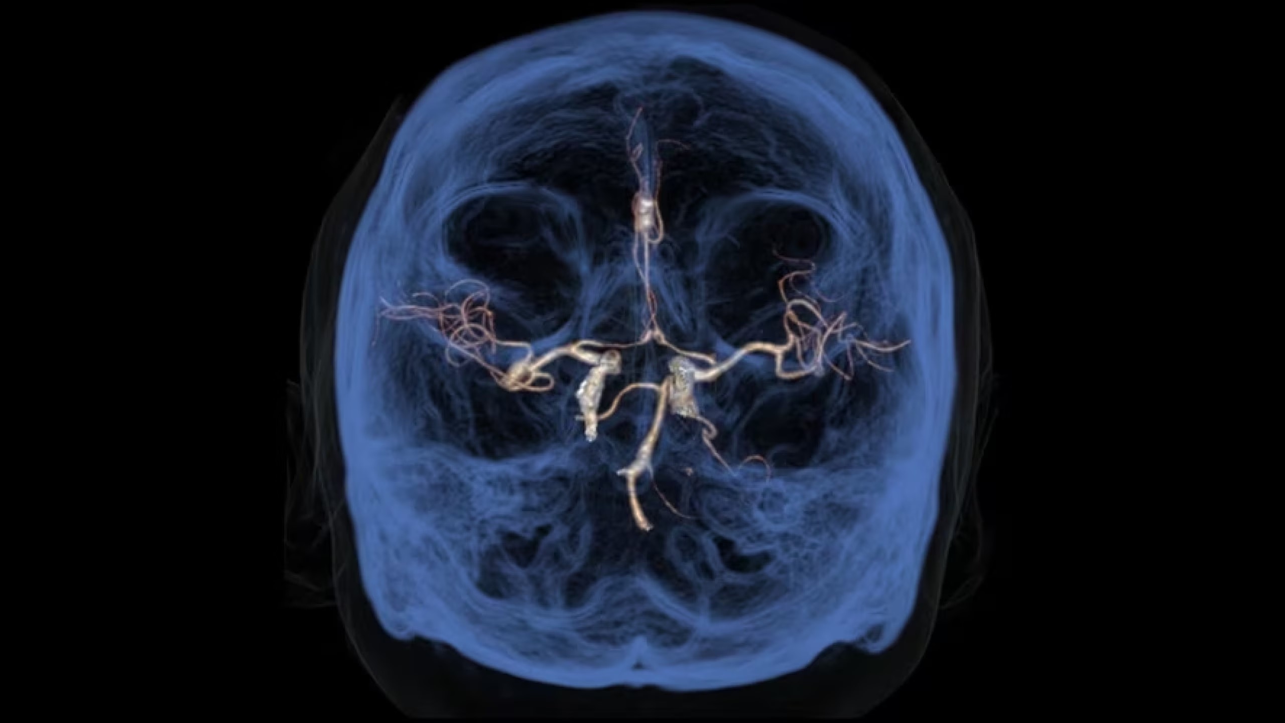 Product Media Carousel Image