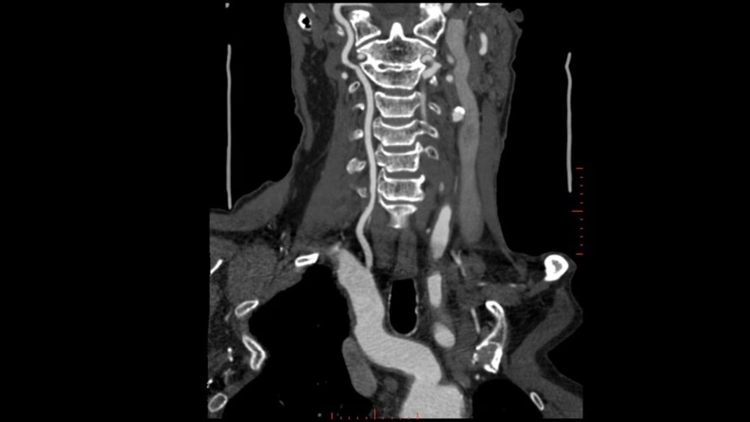 Product Media Carousel Image