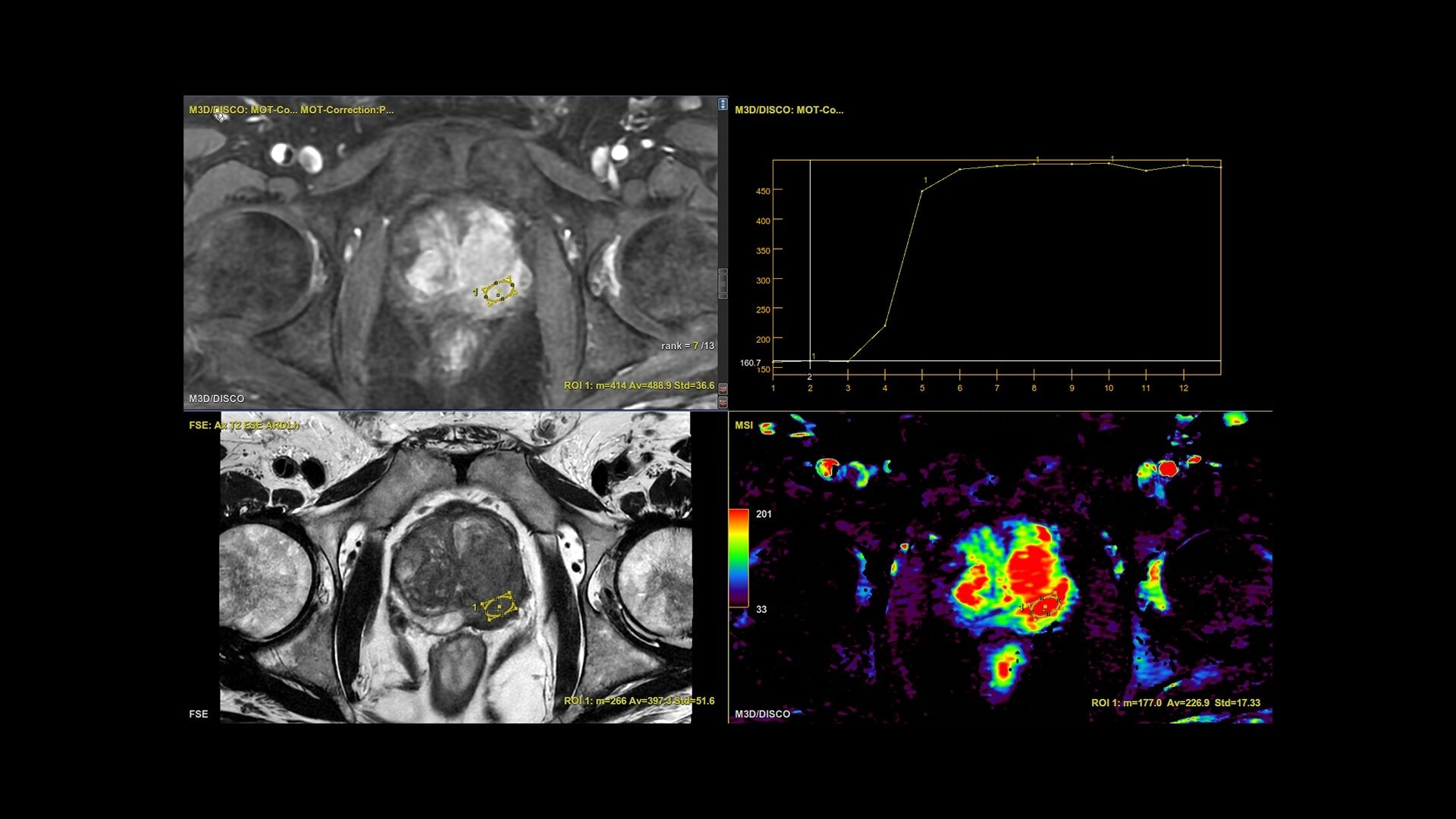Product Media Carousel Image