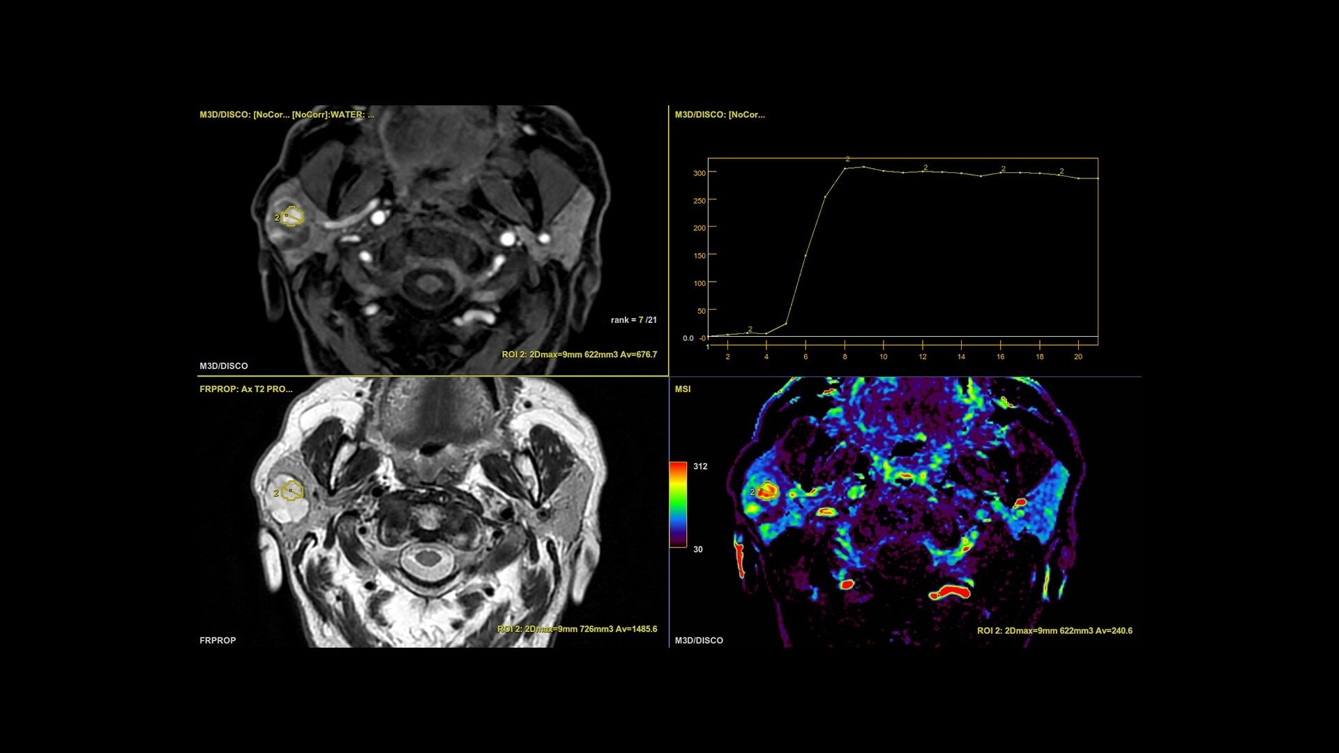 Product Media Carousel Image