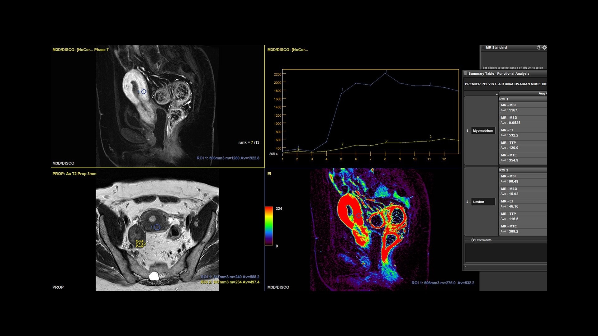 Product Media Carousel Image