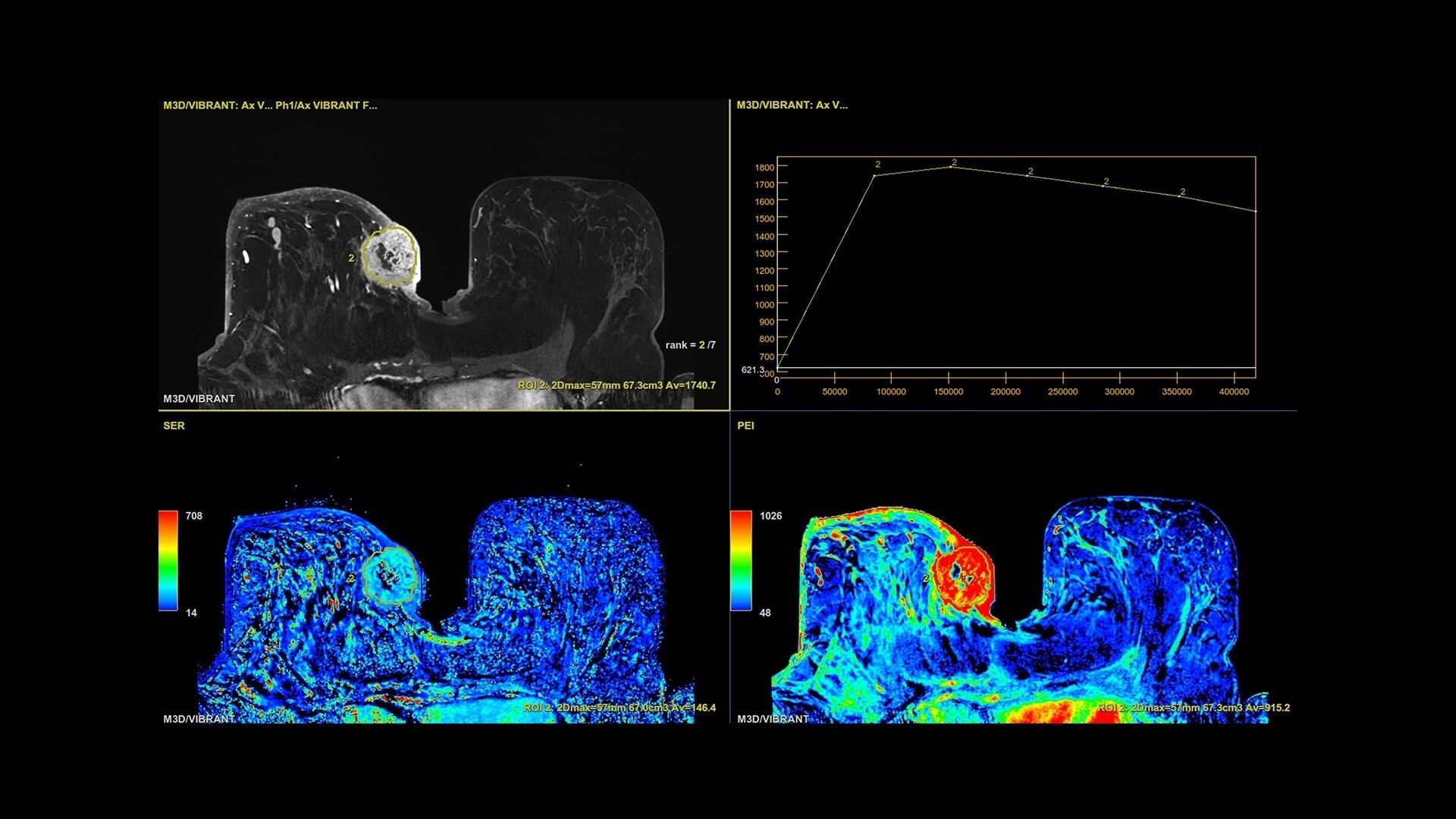 Product Media Carousel Image