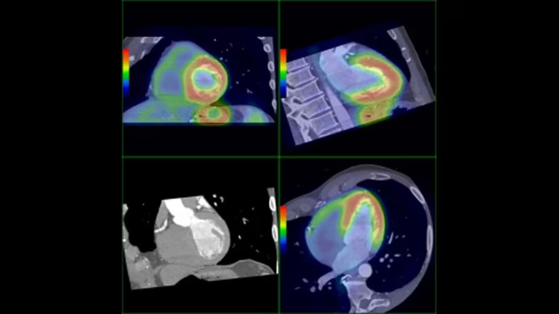 Product Media Carousel Image