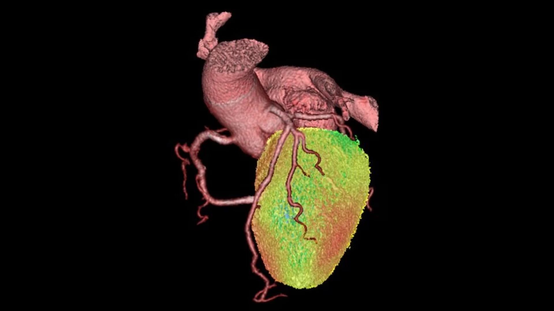 Product Media Carousel Image