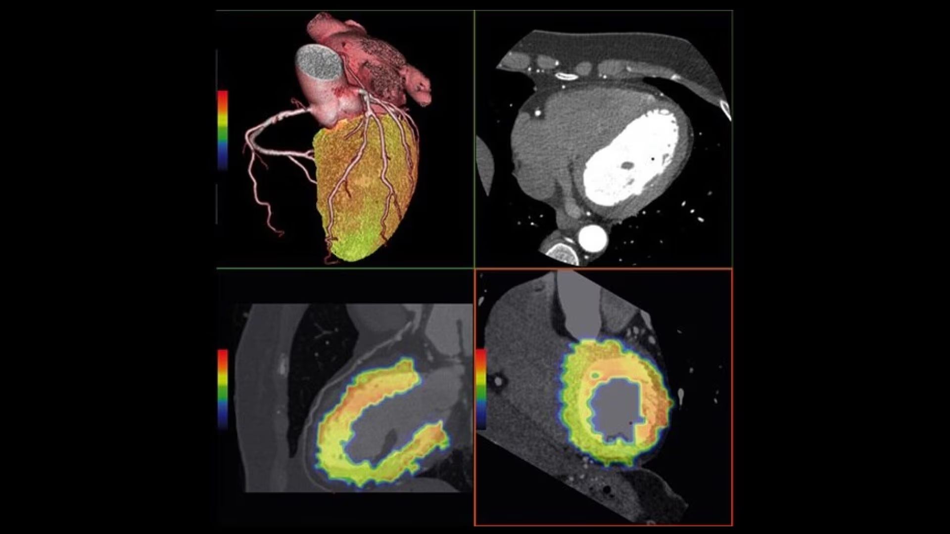 Product Media Carousel Image