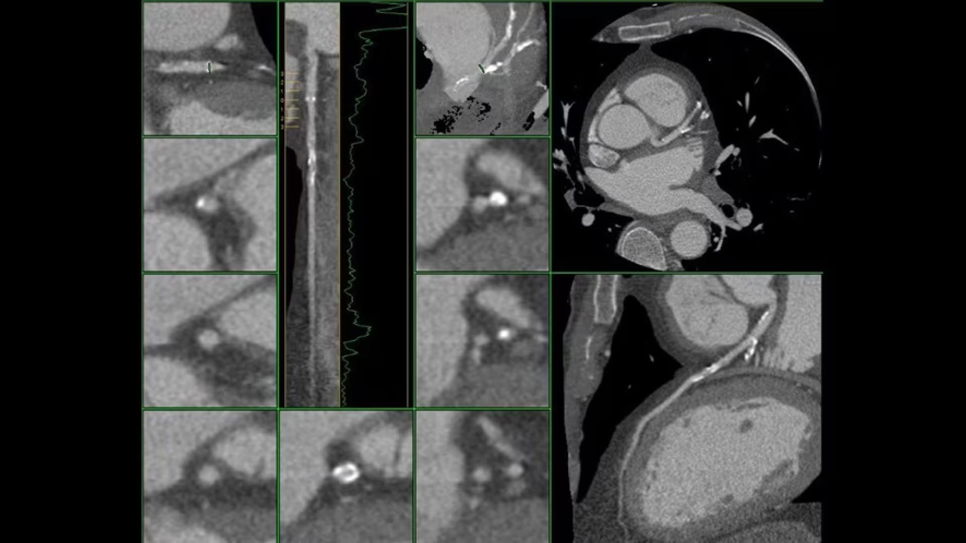 Product Media Carousel Image