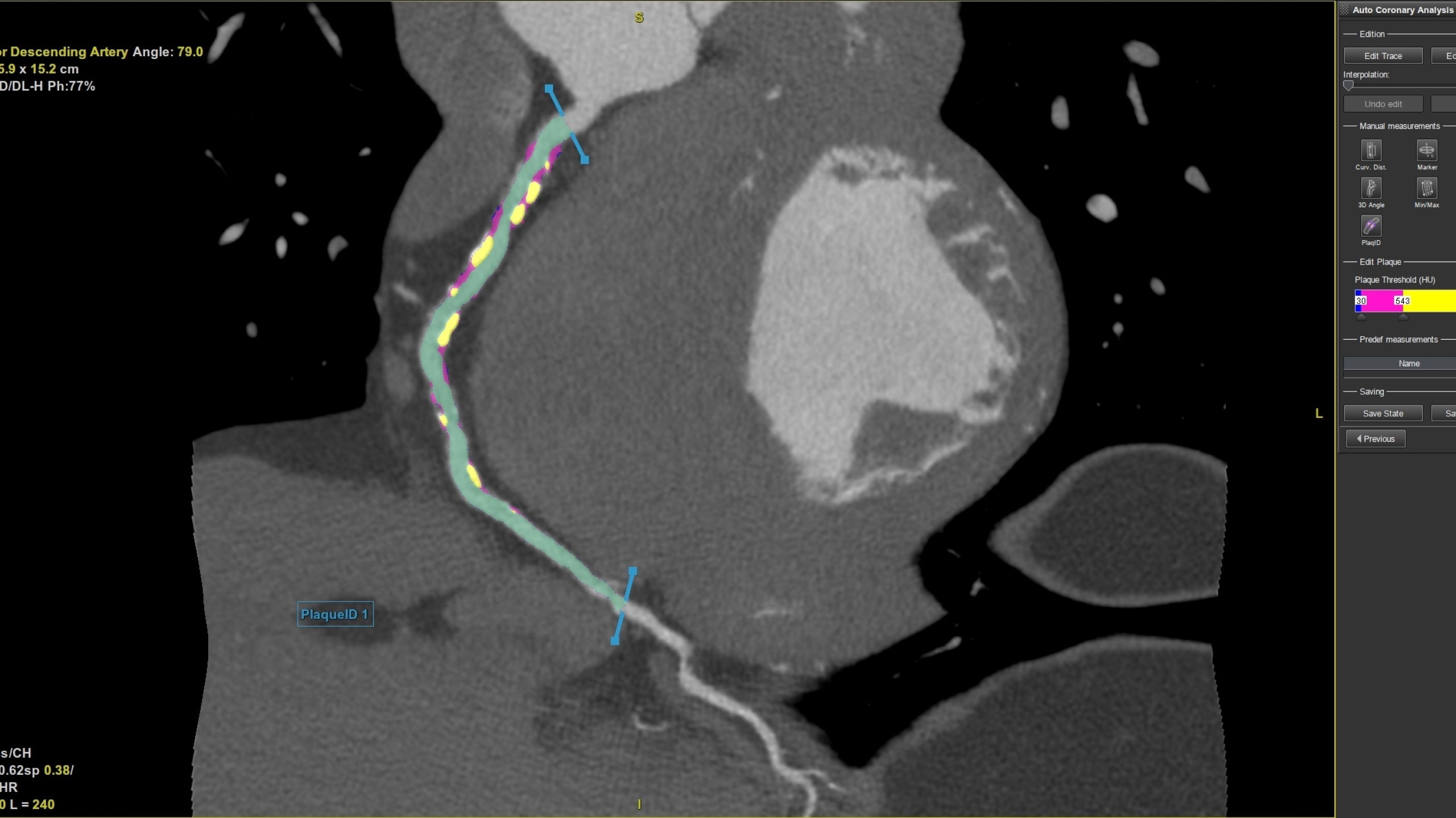 Product Media Carousel Image