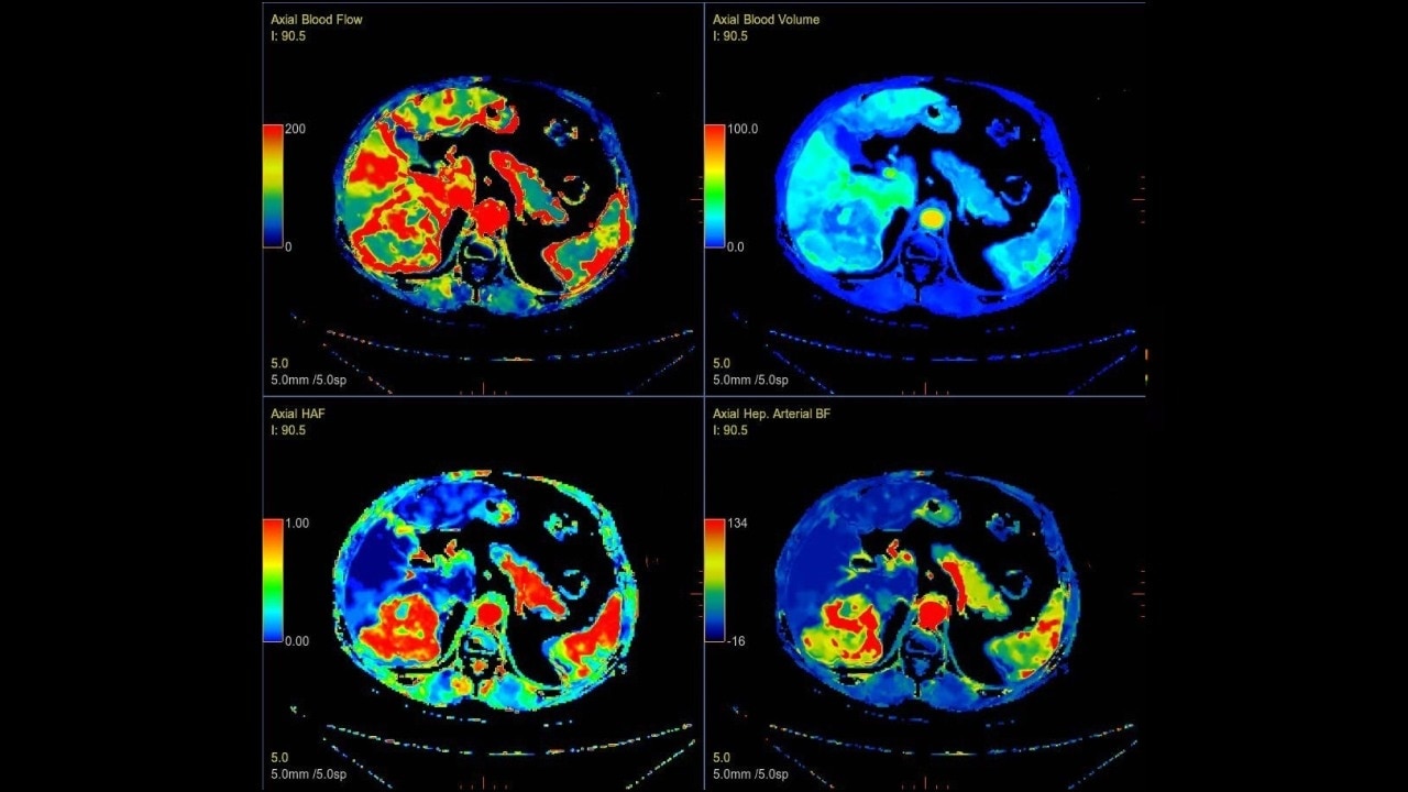 Product Media Carousel Image