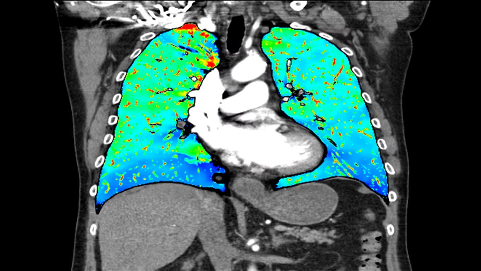 Product Media Carousel Image