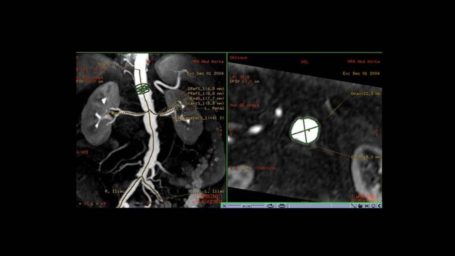 Product Media Carousel Image