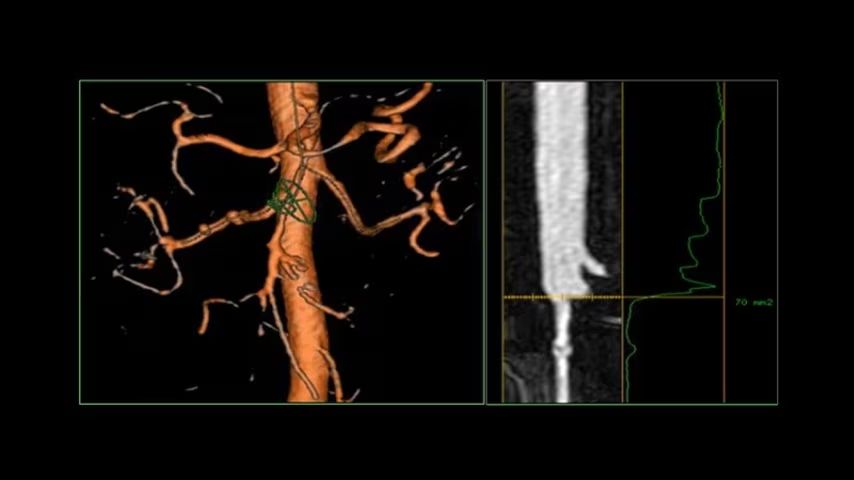 Product Media Carousel Image