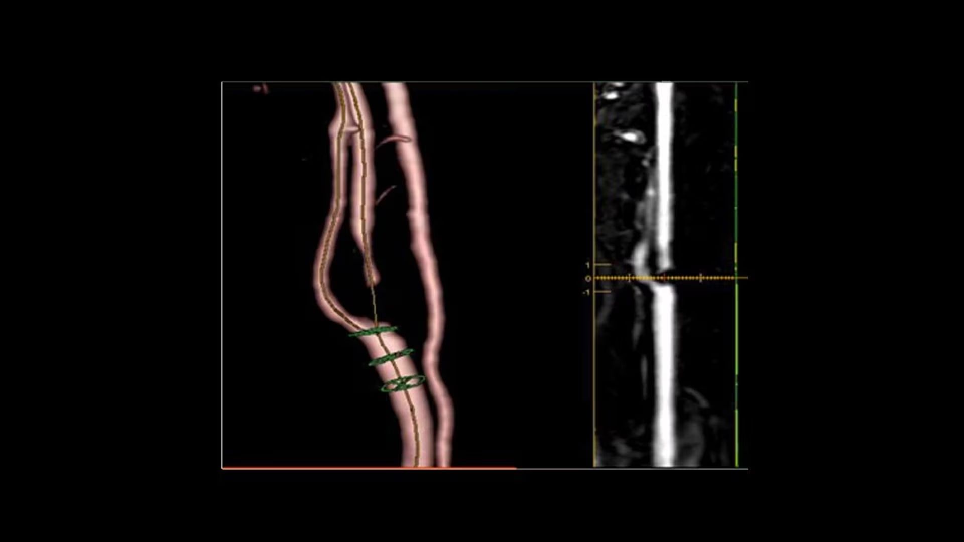Product Media Carousel Image