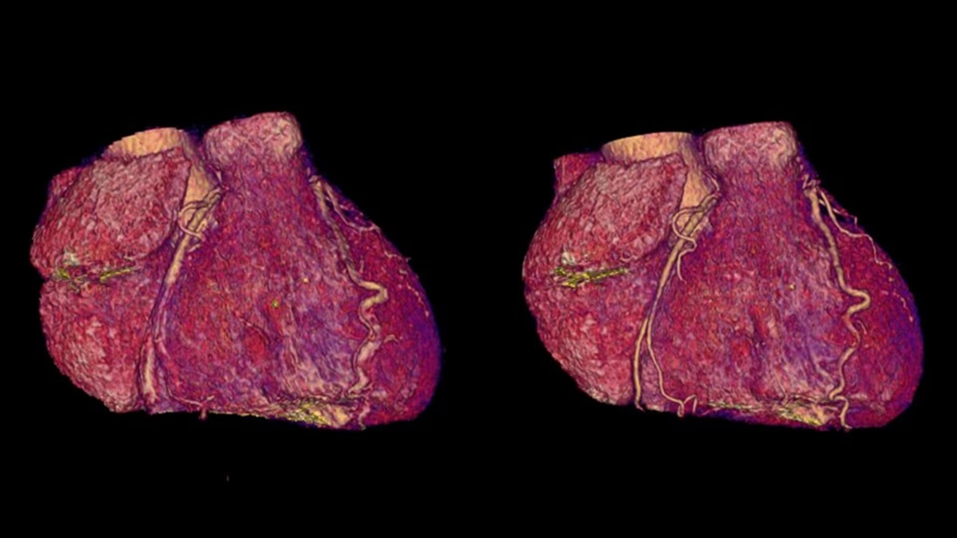 Product Media Carousel Image