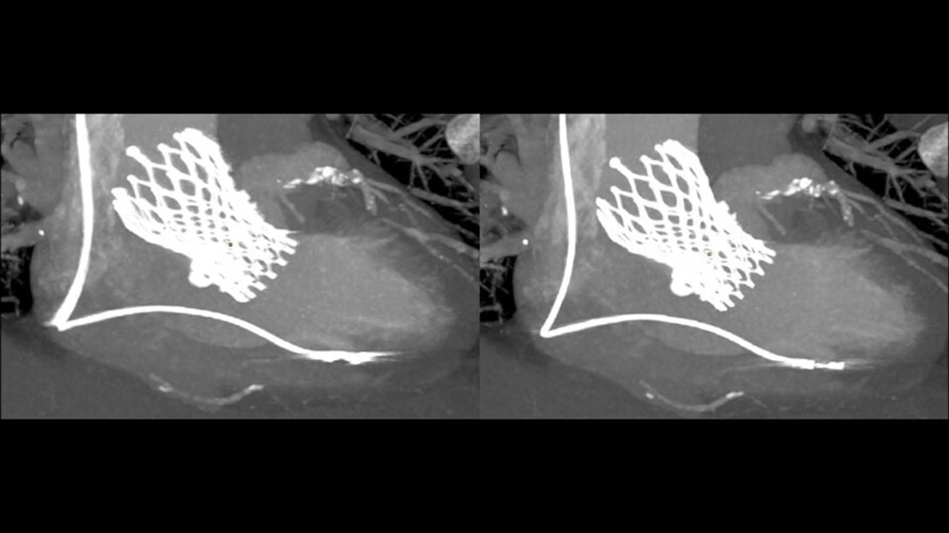 Product Media Carousel Image