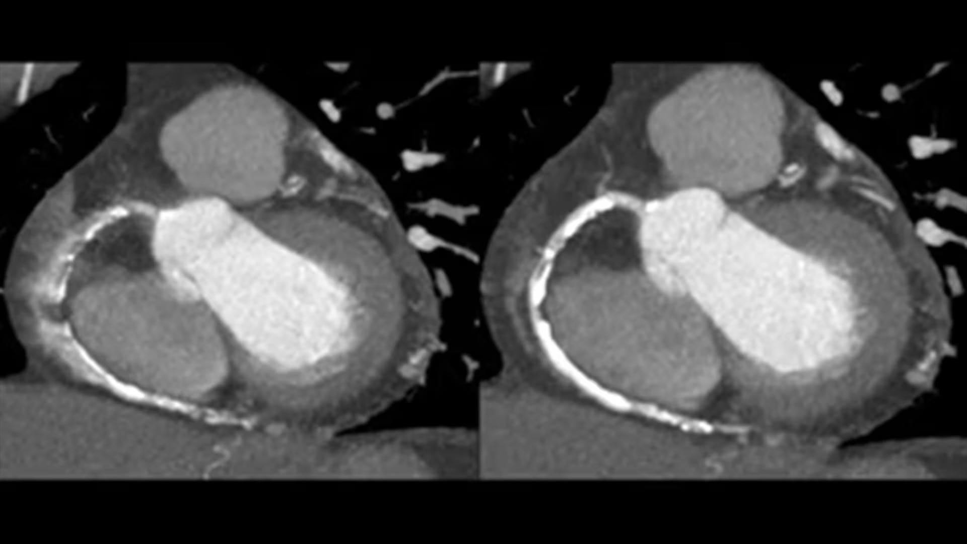 Product Media Carousel Image
