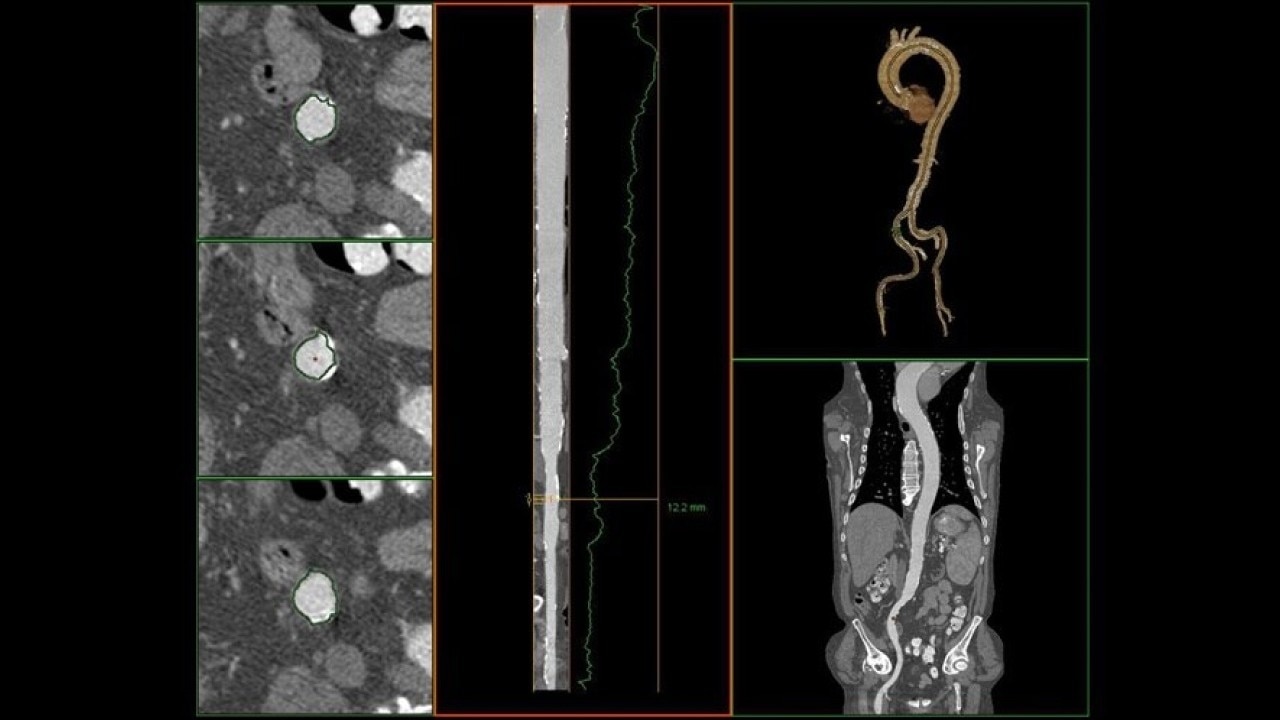 Product Media Carousel Image