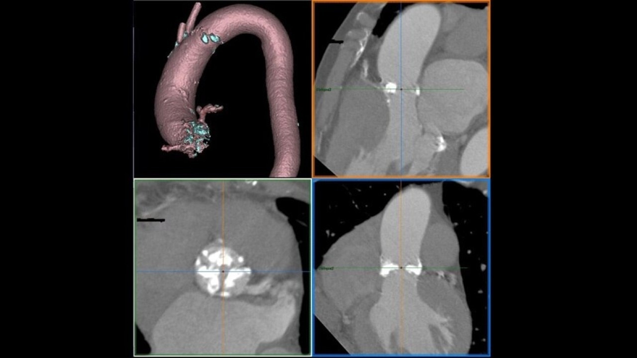 Product Media Carousel Image