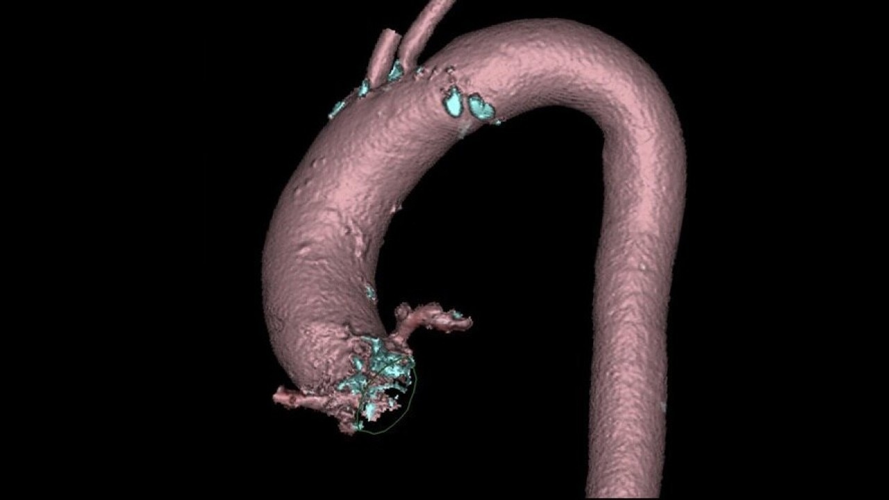 Product Media Carousel Image