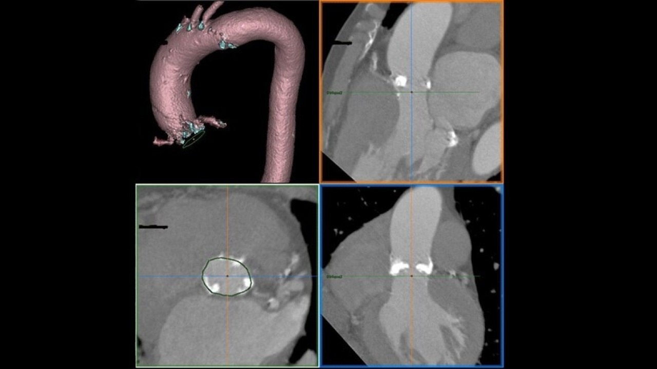 Product Media Carousel Image
