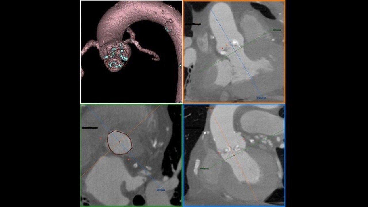 Product Media Carousel Image