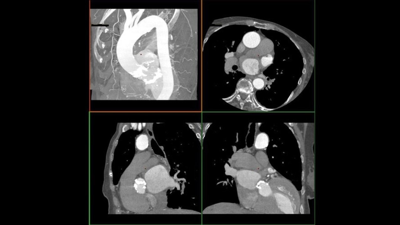 Product Media Carousel Image