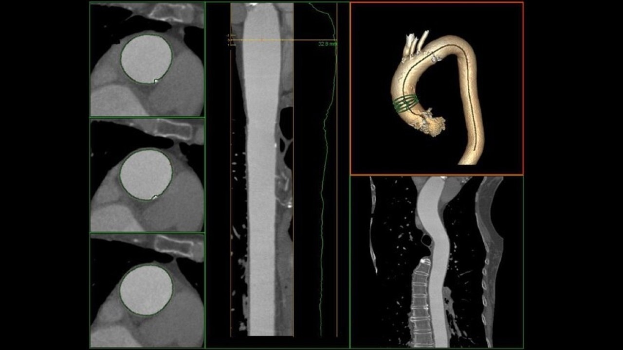 Product Media Carousel Image