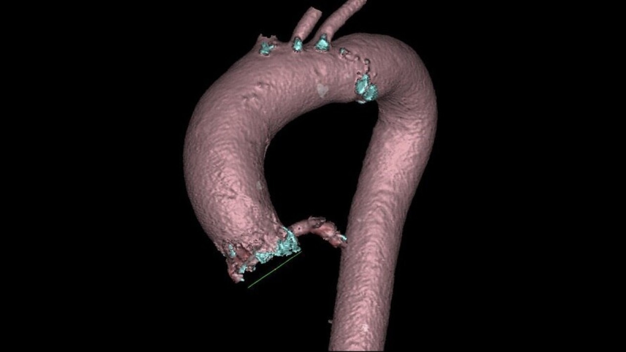 Product Media Carousel Image