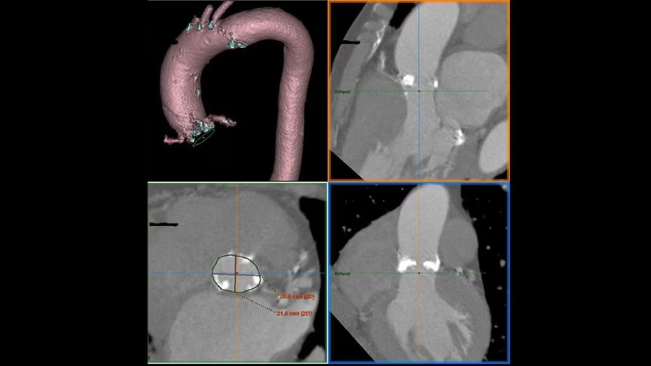 Product Media Carousel Image