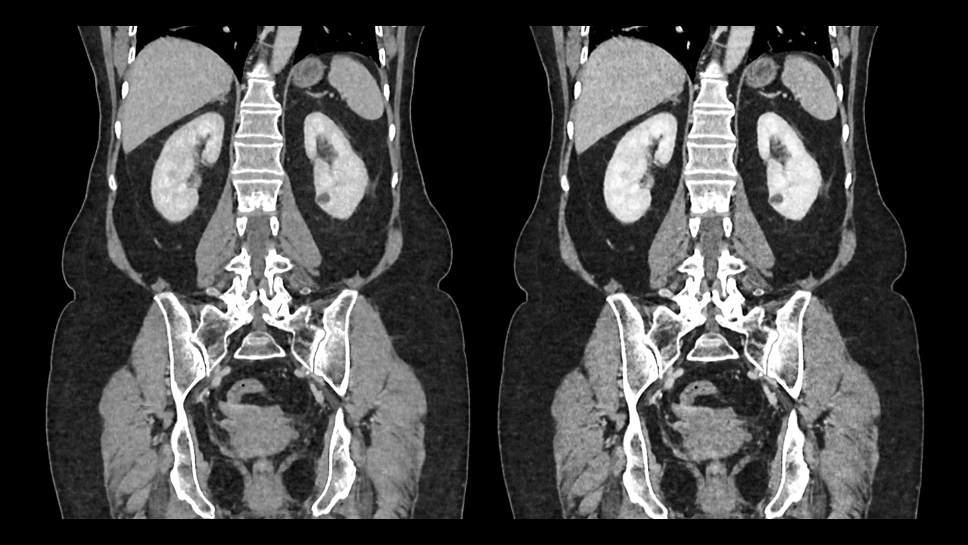 Product Media Carousel Image