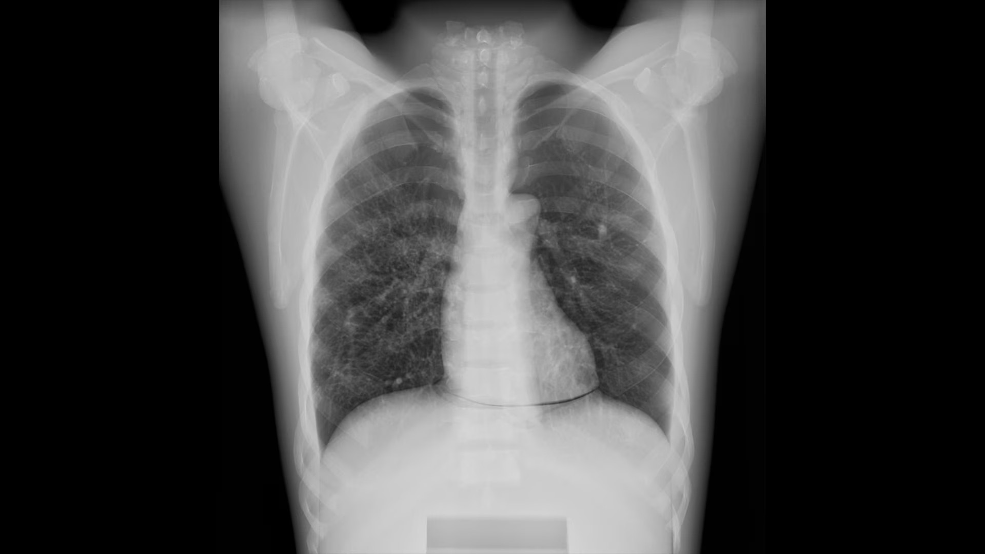 Product Media Carousel Image