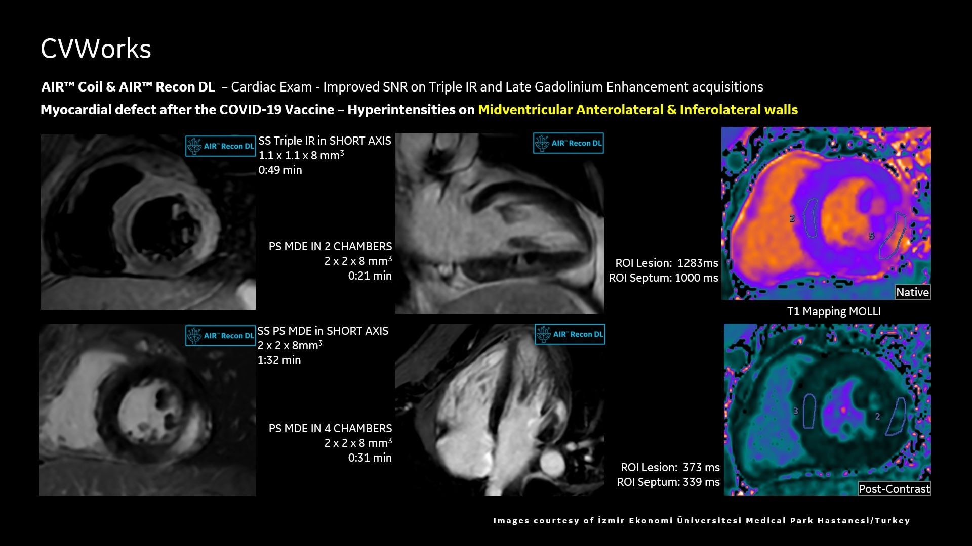 Product Media Carousel Image