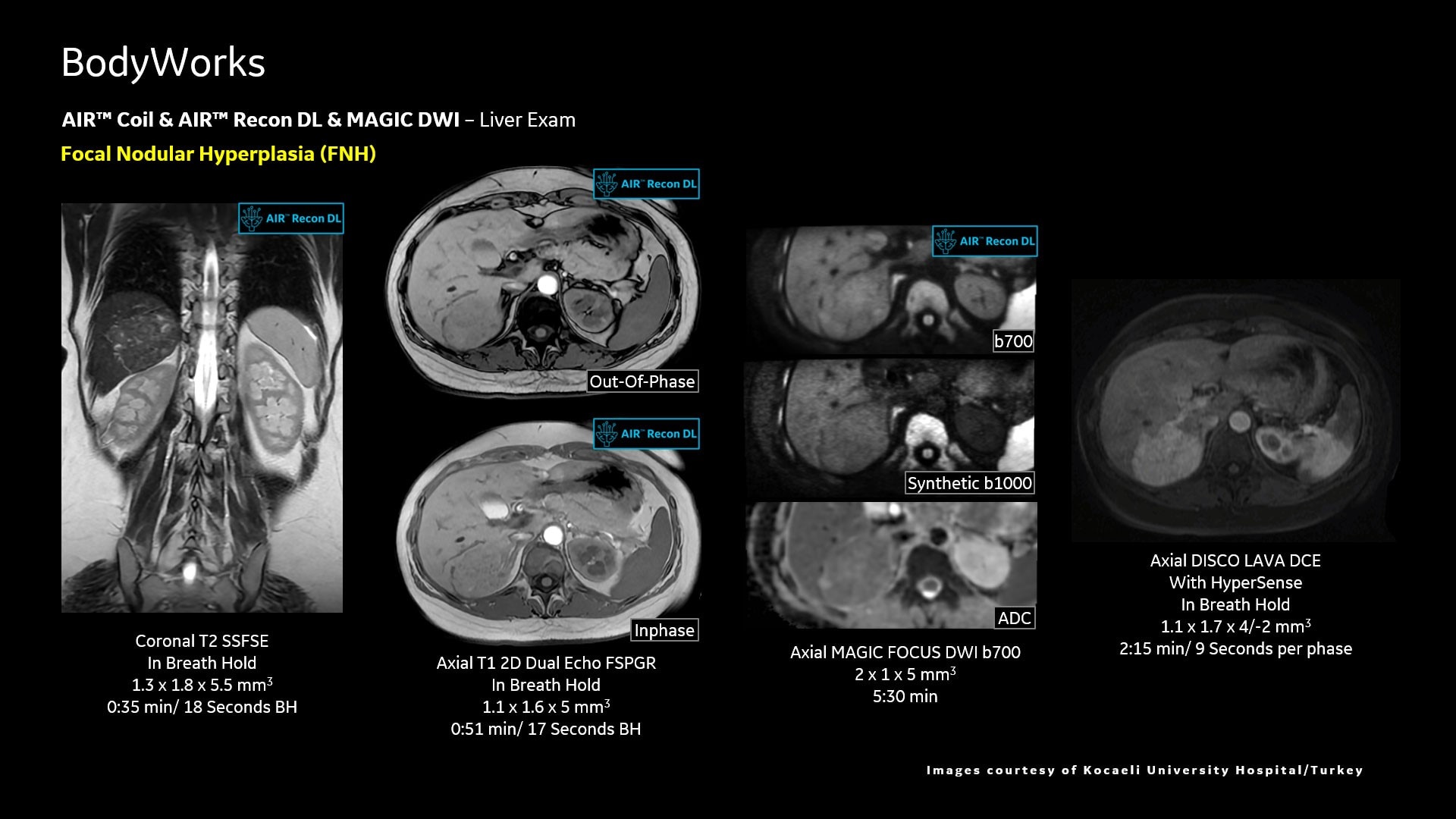 Product Media Carousel Image