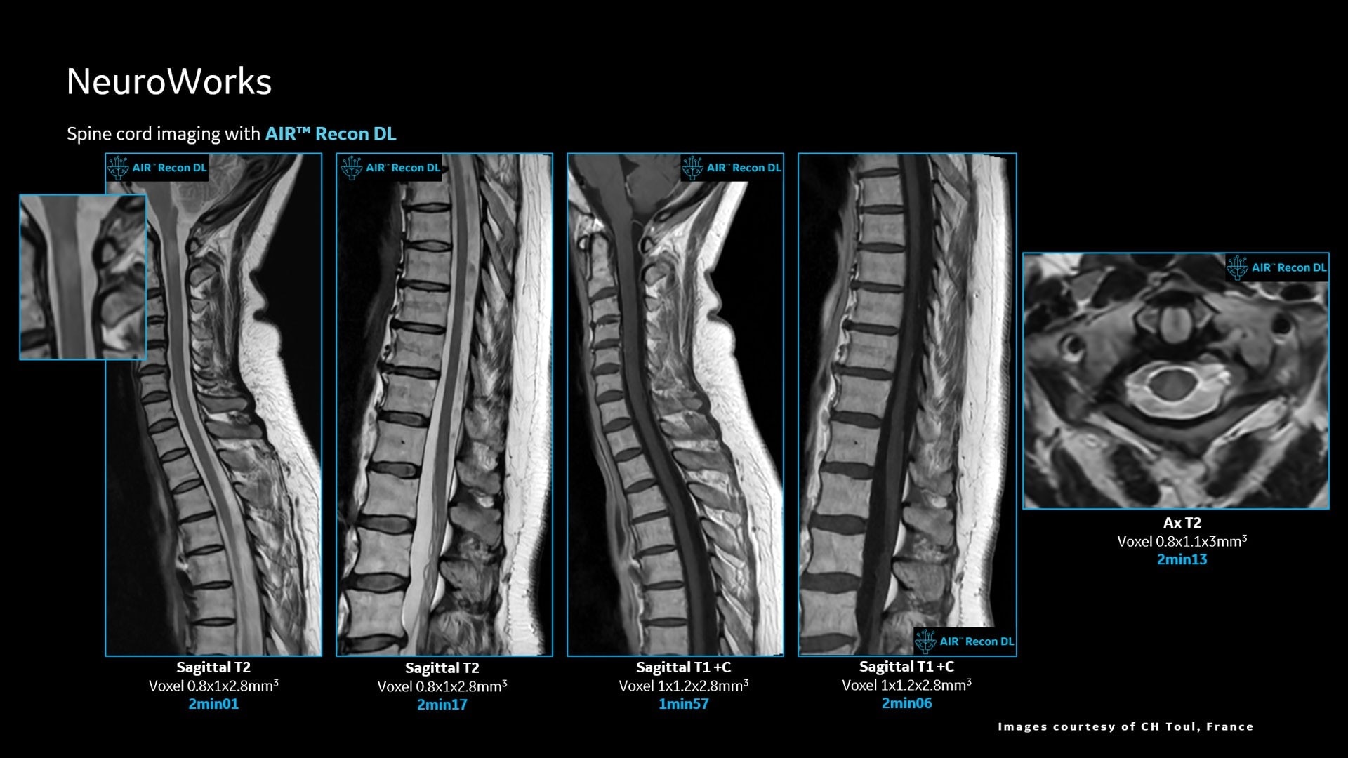 Product Media Carousel Image