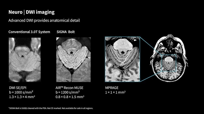 Product Media Carousel Image