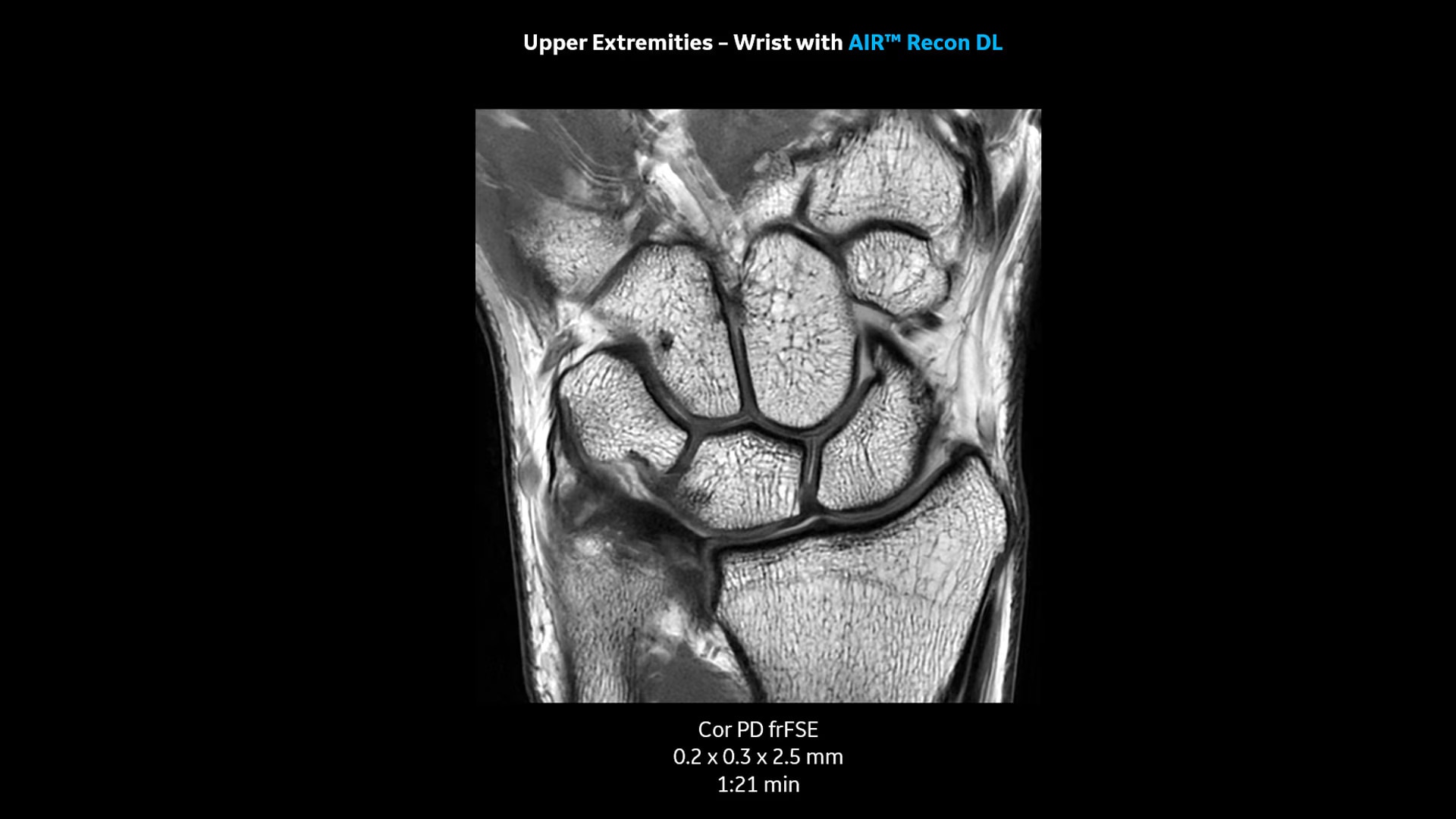 Product Media Carousel Image