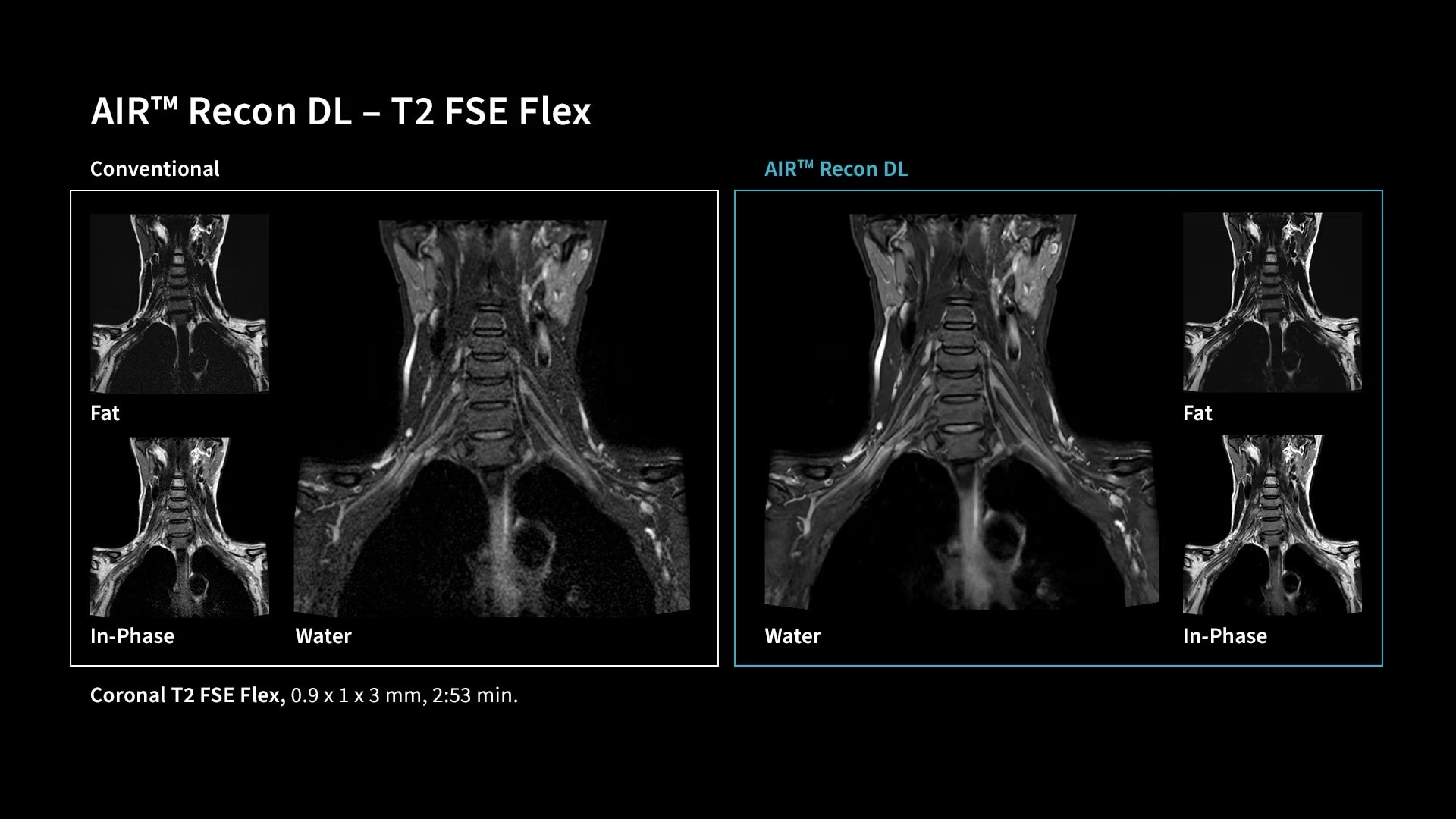 Product Media Carousel Image