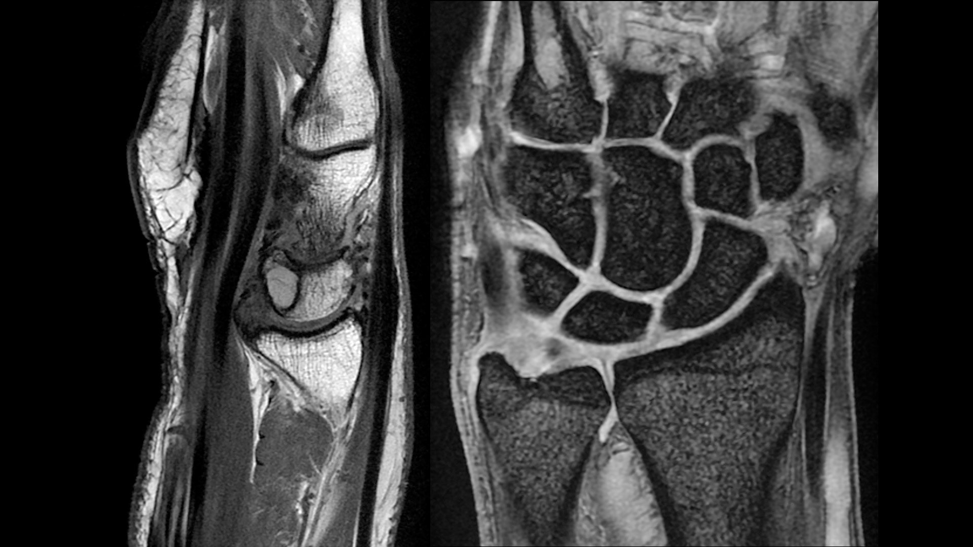 Product Media Carousel Image