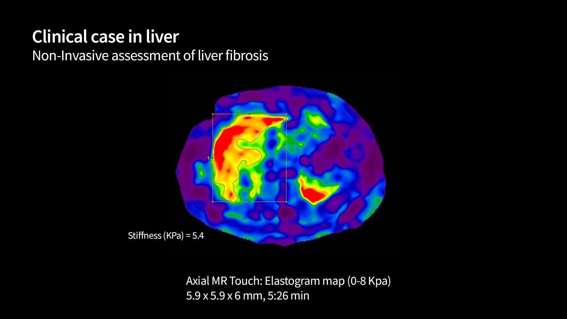 Product Media Carousel Image