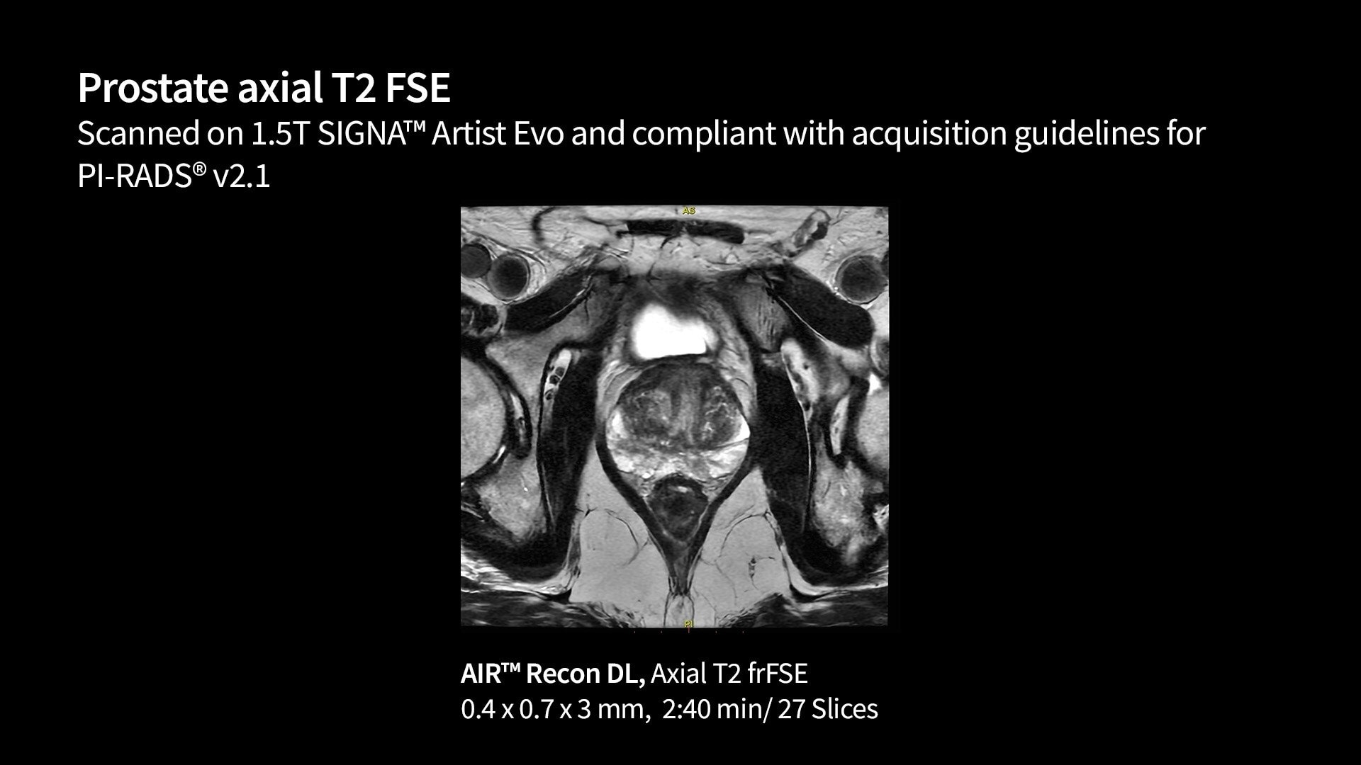 Product Media Carousel Image