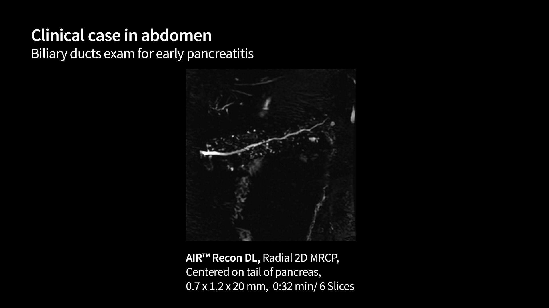 Product Media Carousel Image