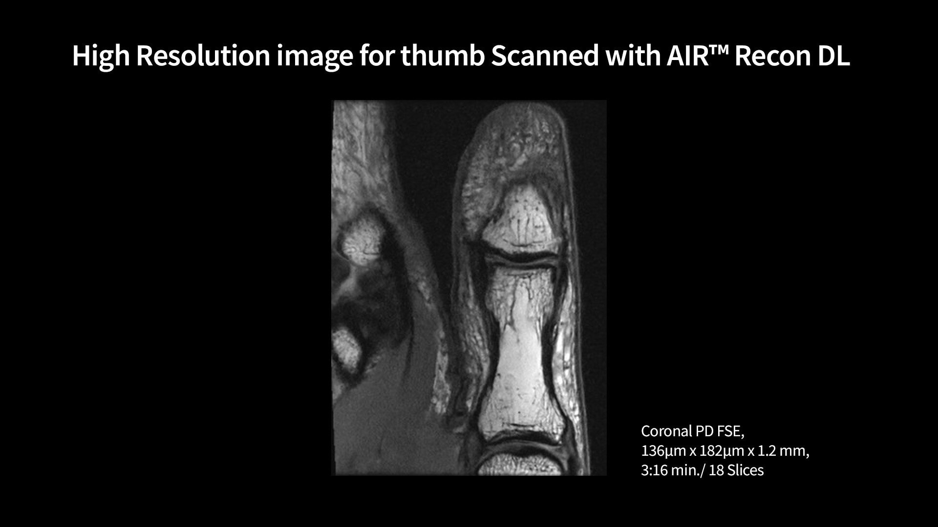 Product Media Carousel Image