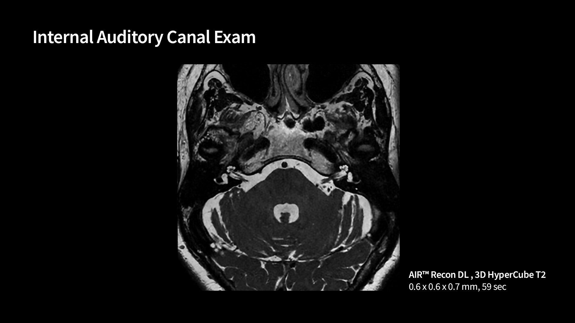 Product Media Carousel Image